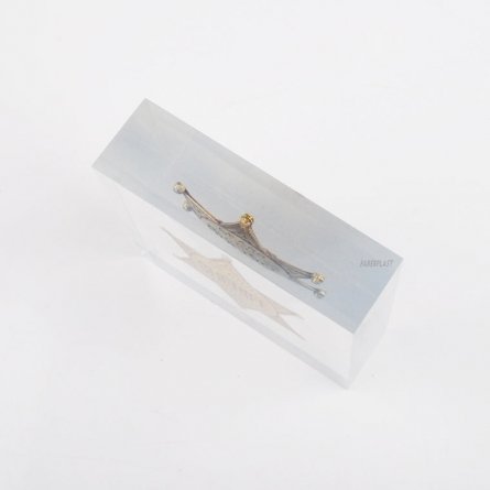 Oclusión en resina ESTRELLA SHERIFF